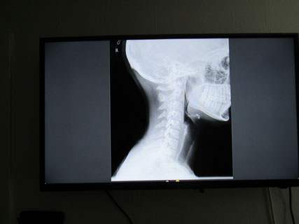 Image of an x-ray